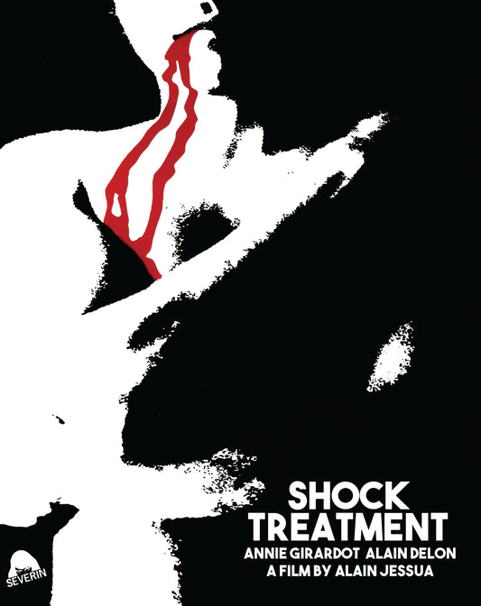 Shock Treatment (limited Edition) (Blu-ray)